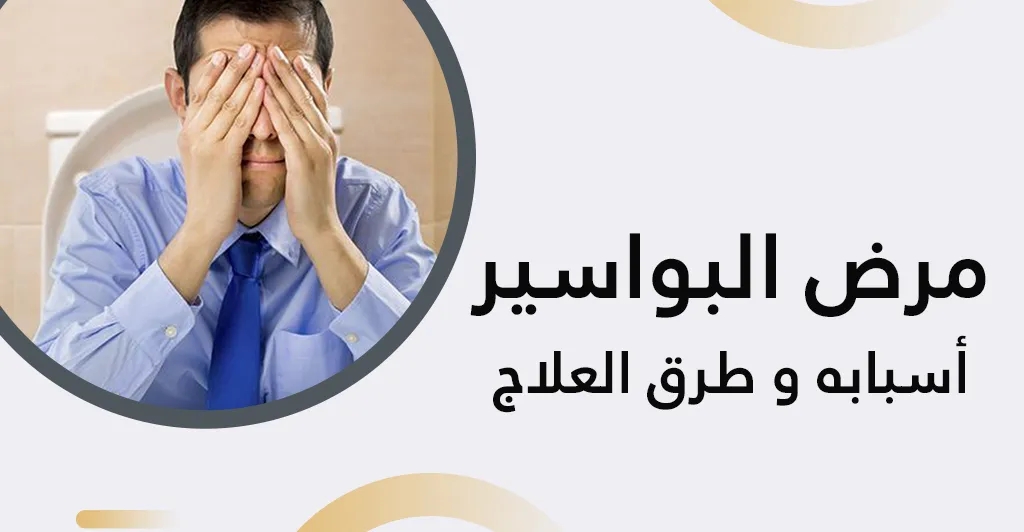 مرض البواسير : أسبابه و طرق العلاج